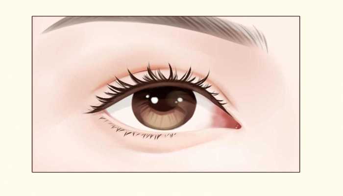 蓝衣记者“翻白眼”爆红，翻白眼也能治病