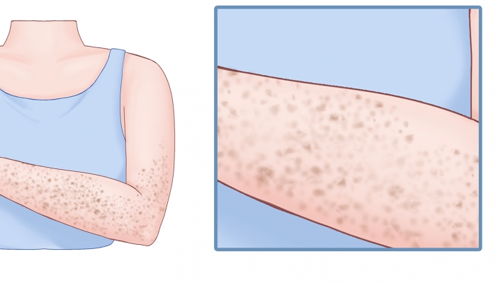 药店里这种药片，每天用来抹脸，能淡化斑点白嫩肌肤