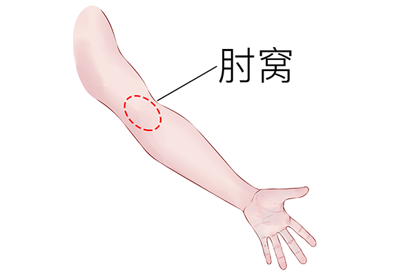 找准原因，每天只花几分钟，轻松告别“粗胳膊”