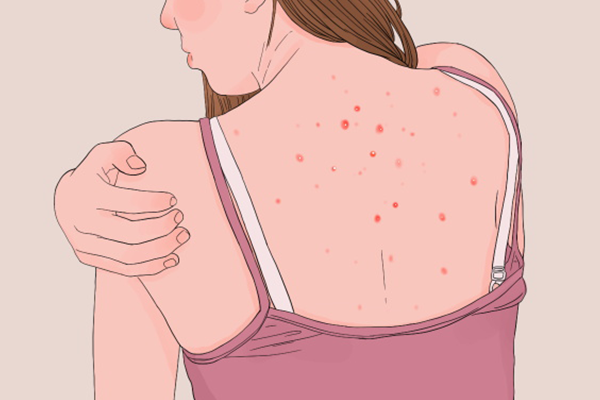 寒湿体质有哪些特点？寒湿体质怎么减肥