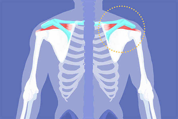 周末健身达人：提高安全意识，预防运动损伤