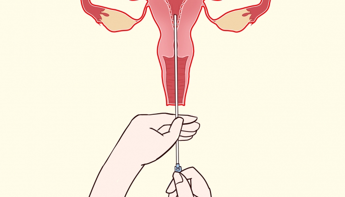 欧迪玛抑菌凝胶的作用与功效