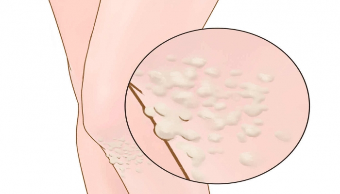 钙尔奇钙片适用人群