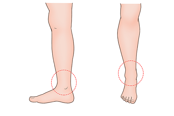小腿肥肉多怎么减？六个简单动作轻松甩掉赘肉