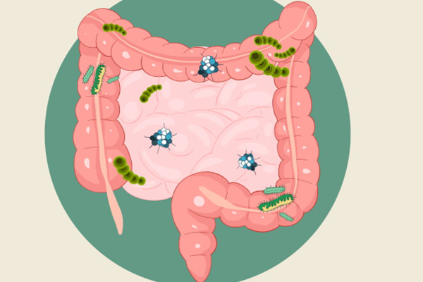 消水肿绝对能显瘦！如何消水肿