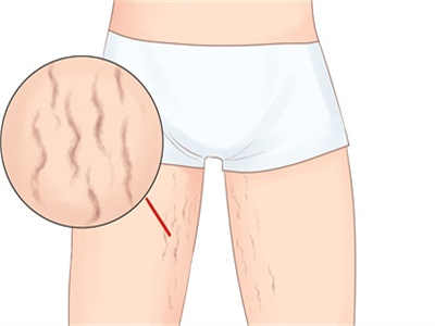 一个月轻松瘦十斤的晚餐减肥法