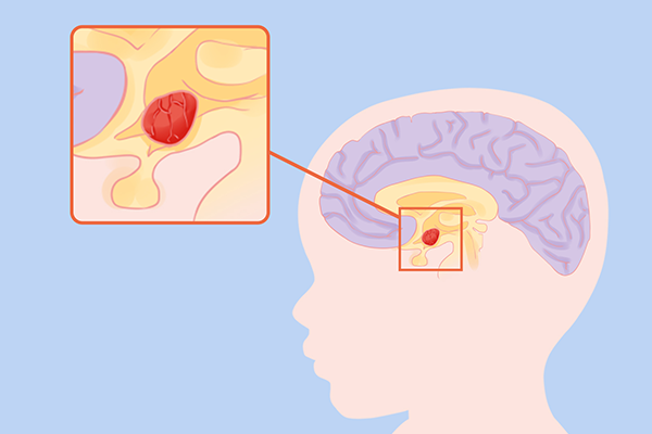 学生选择节食来减肥会不长个头嘛？