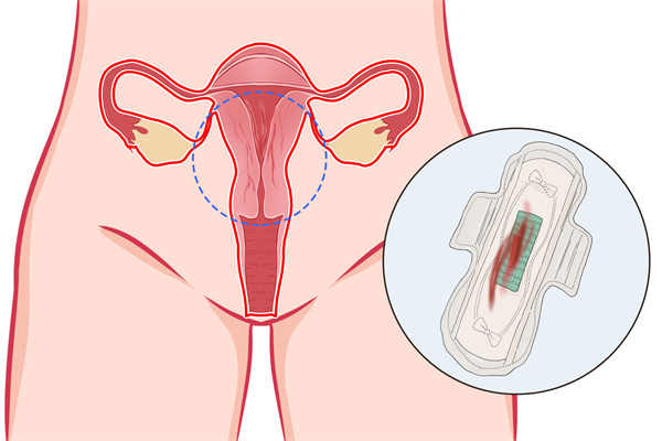 经期能够打肉毒素减肥吗？？