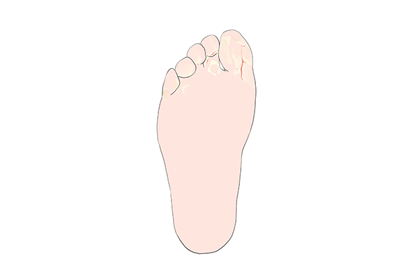 脚长胖了，怎么保养？