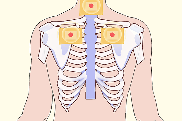 瘦身贴是什么原理？