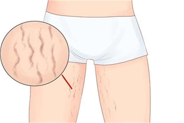 你的“减肥”其实是变相增肥？