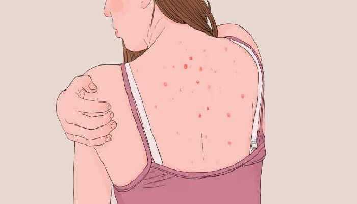 蛹虫草长期性吃有副作用吗？ 什么样的人不能吃蛹虫草