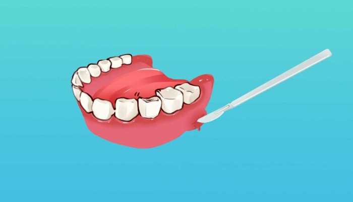 芋头的功效与作用 芋头的食用禁忌