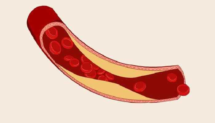 西红柿炒豆芽的营养价值 豆芽的功效