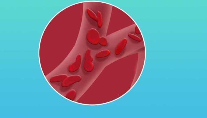 核桃仁的热量 核桃功效