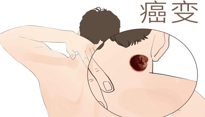 ​常喝纯牛奶有什么好处 牛奶的作用