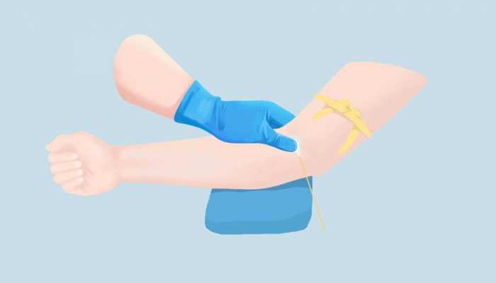 动脉曲张吃什么好，孕妇患有动脉曲张吃什么好呢?