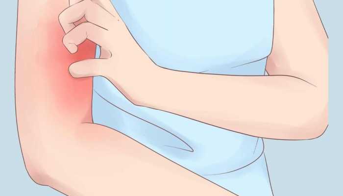 黄桃过敏怎么办 吃黄桃的注意事项有哪些