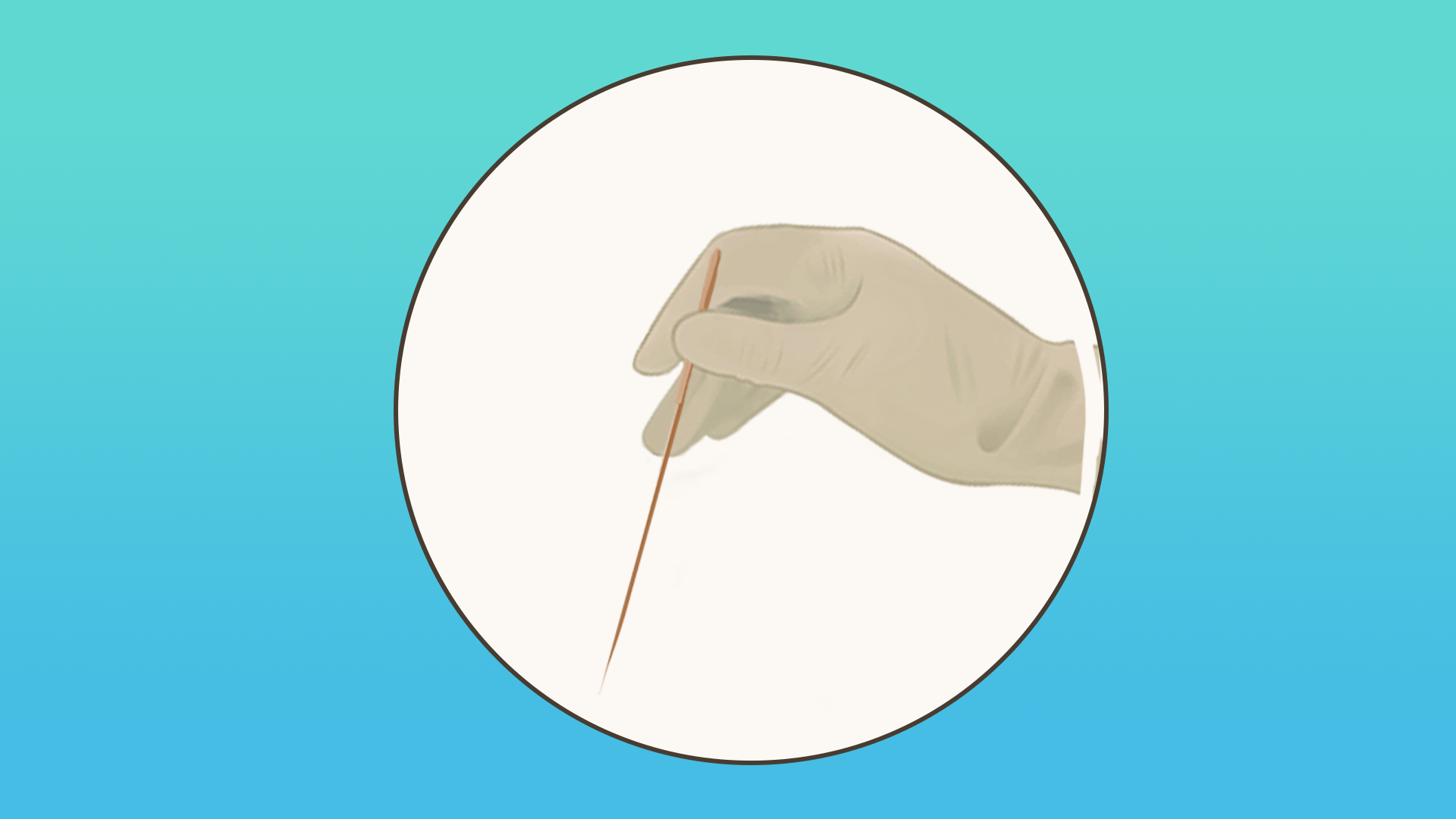 针灸减肥的注意事项 减肥不要盲目