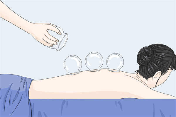 拔罐减肥原理必须懂 遵守方法不复胖