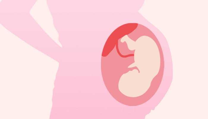 胎盘老化发白危害大，警惕胎儿窒息！