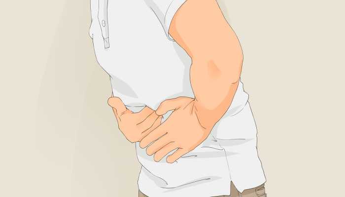 继发性腹膜炎，你想知道的都在这儿！