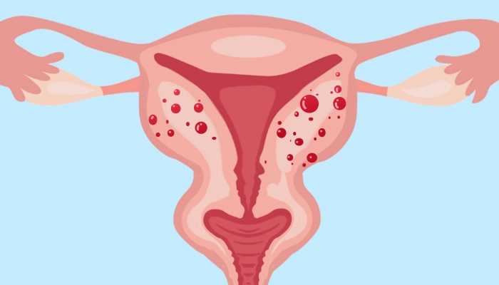子宫内膜异位表现，这两点值得关注