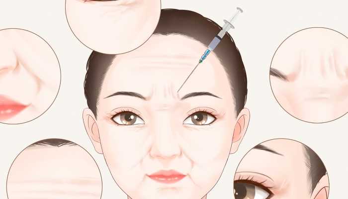 面部除皱新方法