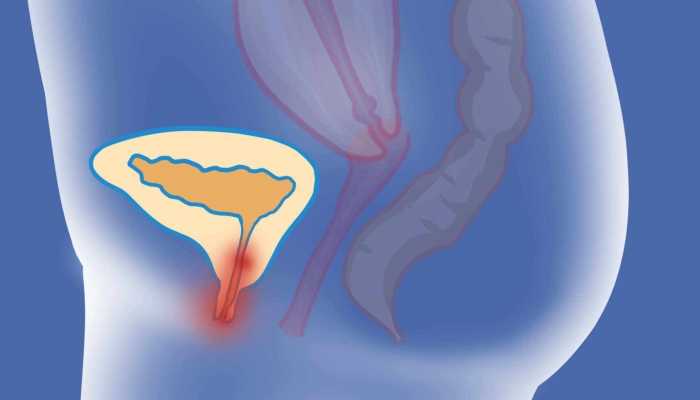 尿床怎样无声快速干