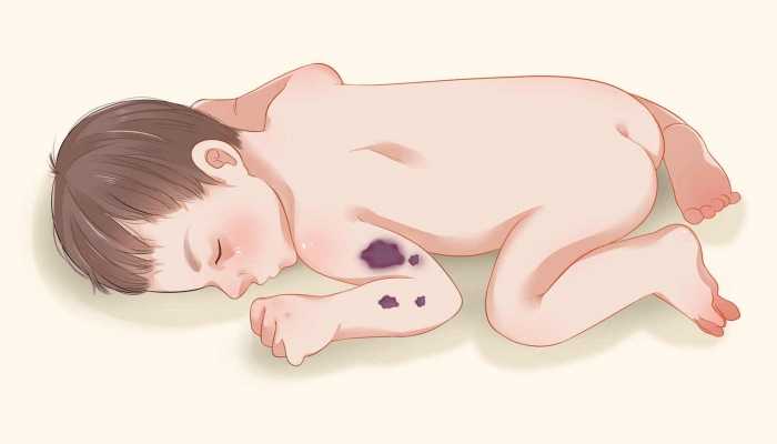 儿童检查阴茎