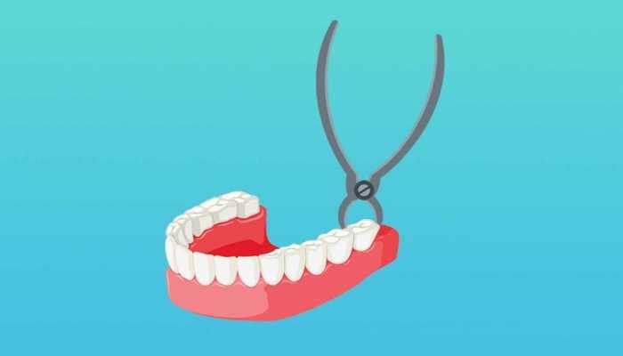 拔牙后多久吃消炎药 拔完牙要注意什么