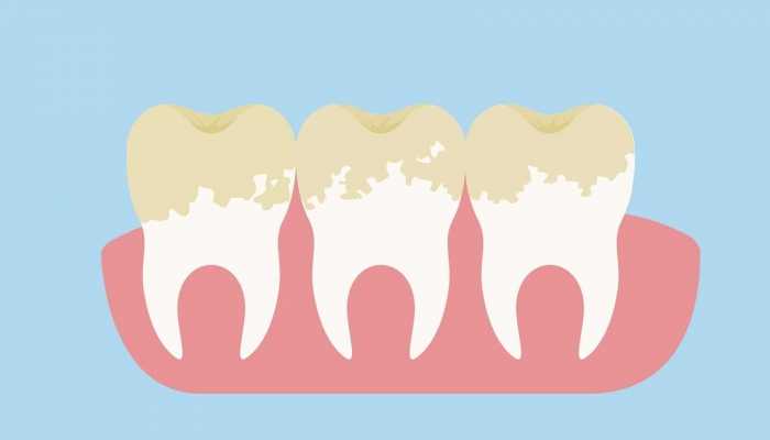 女人喝可乐的坏处 可乐的坏处