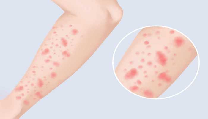 淮山米粉的营养价值 淮山米粉的禁忌