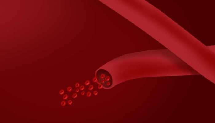 女人喝红茶能减肥吗？ 喝红茶的好处