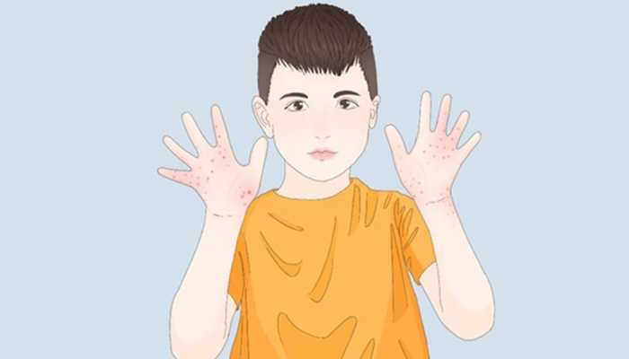 马齿苋能治皮肤病吗？ 马齿苋能治什么皮肤病