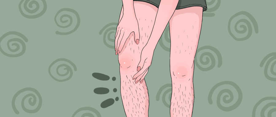 女性雄激素升高的症状 女人雄激素过高吃什么好