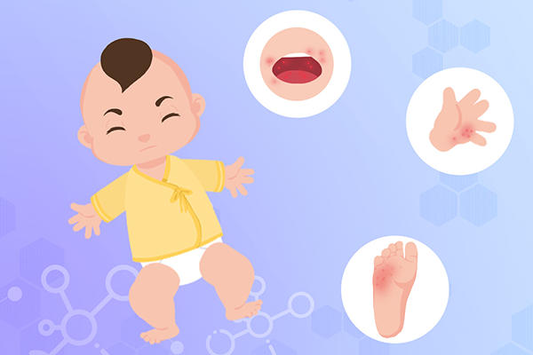 手足口怎么引起的 为什么会得手足口