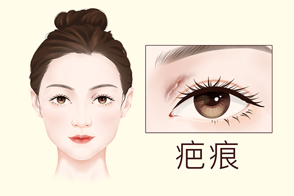 叶黄素对眼睛有什么好处和作用 叶黄素的五大好处