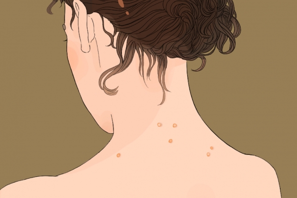 湿气重怎么调理最快 湿气重的危害