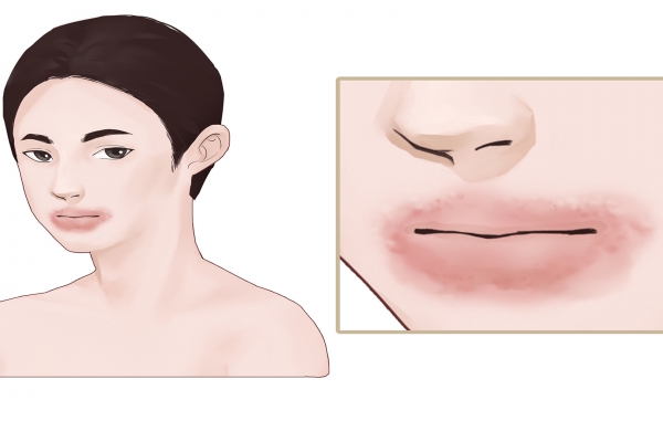 海鲜过敏的人能吃小龙虾吗？ 海鲜过敏的人适合吃什么食物