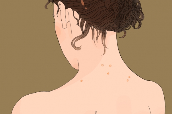 三伏天吃什么祛湿气快 三伏天怎么排湿气寒气