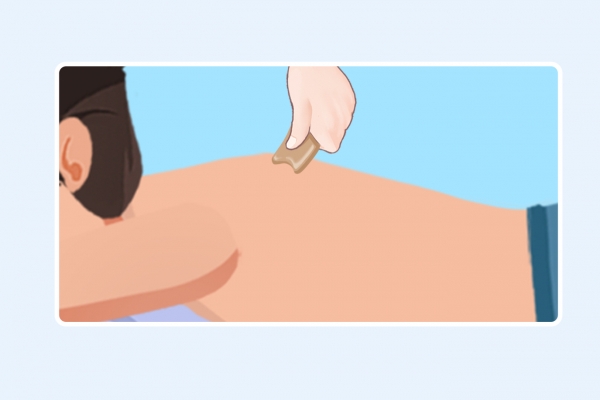 三伏天刮痧拔罐的好处和坏处 拔罐和刮痧哪个去湿气