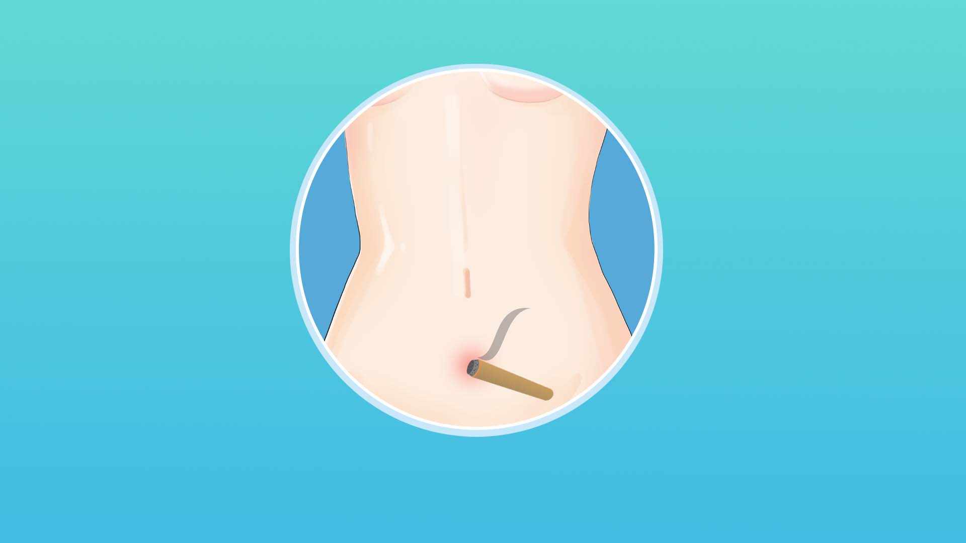 三伏天小儿艾灸肚脐的好处 小儿脐灸的优点