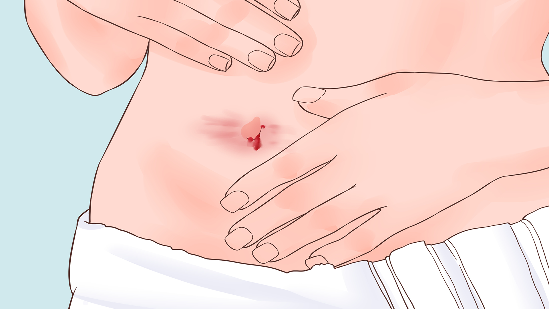 三伏天小儿艾灸肚脐的好处 小儿脐灸的优点