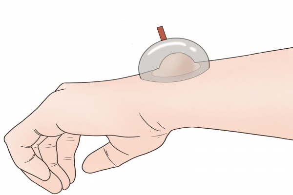 三伏天中午可以拔火罐吗？ 三伏天拔罐的最佳时间