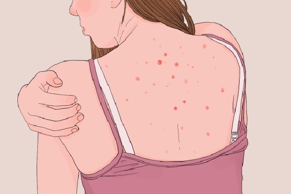 银手镯戴在手上可以祛湿吗？ 去湿气好的方法