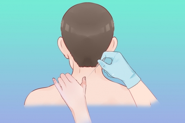 三伏天可以天天艾灸背吗？ 三伏天艾灸背的好处