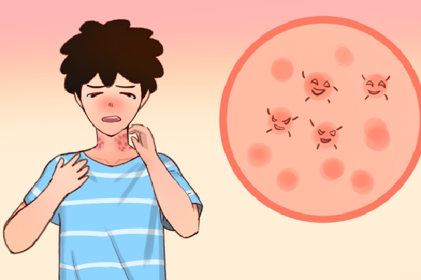 三伏天怎么去除体内湿气 三伏天养生五大要点