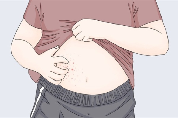 三伏天出汗能祛湿气吗？ 三伏天出汗的好处