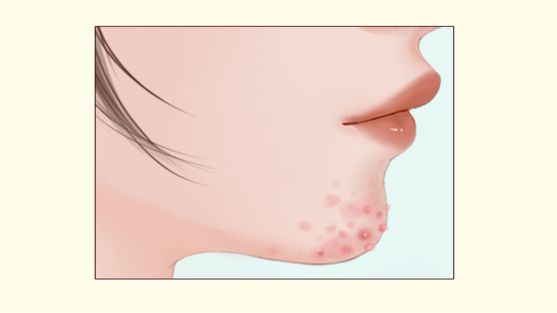 三伏天里该如何保养皮肤 三伏天护肤小妙招